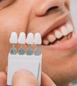 A patient smiling while a dentist holds up porcelain veneer shade samples during a veneers consultation in Great Neck at TruYou Dental