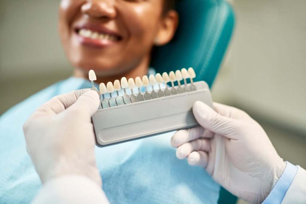 Dental Bonding and Porcelain Veneers