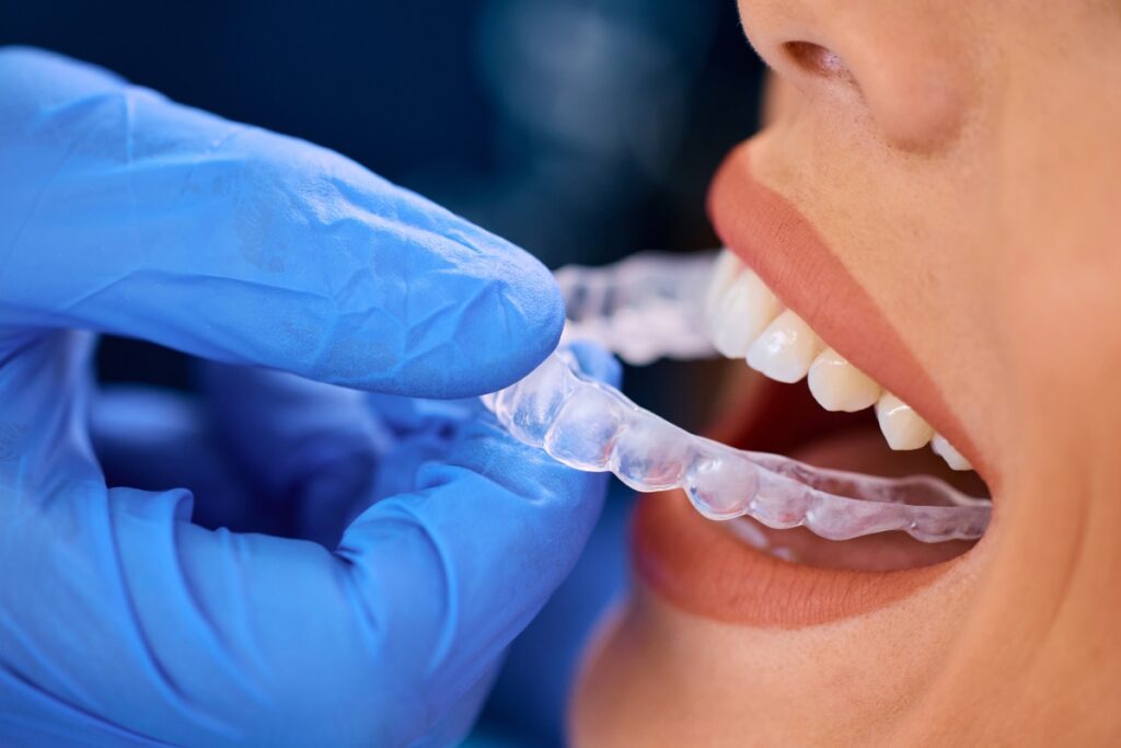 long-term benefits of Invisalign