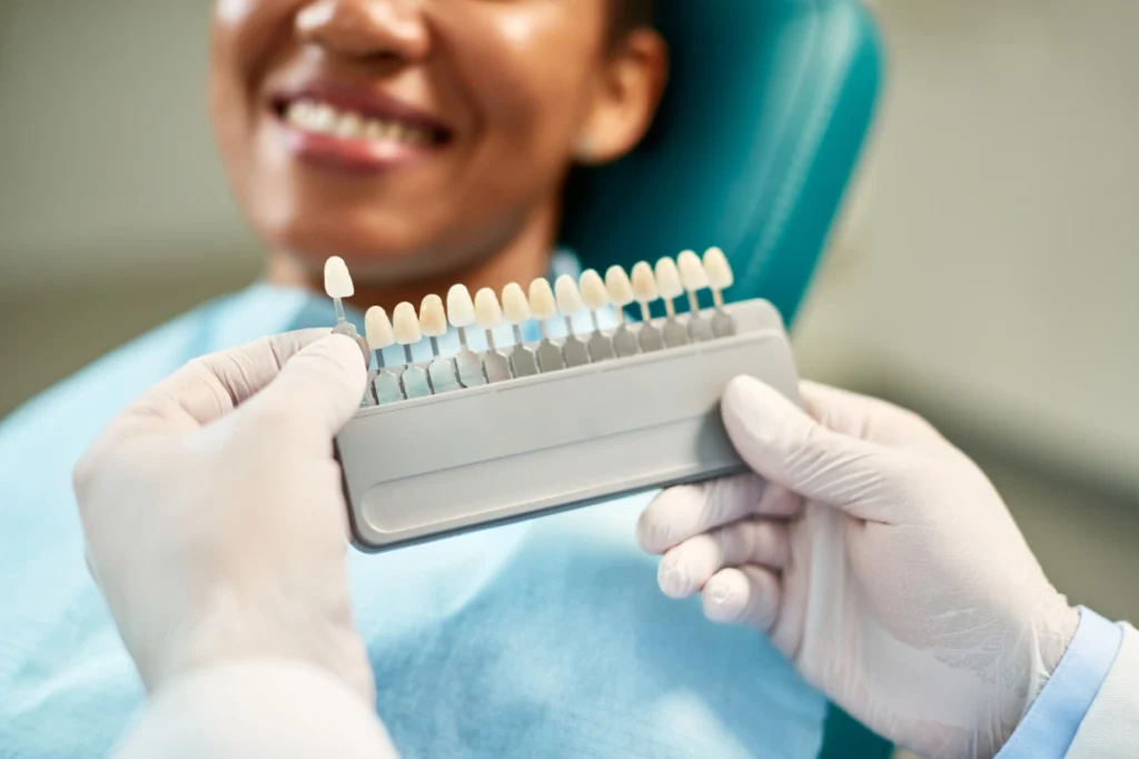 Dental Bonding and Porcelain Veneers