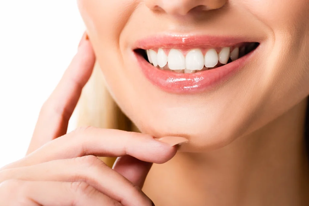 Teeth Whitening vs. Veneers: Which is Best?